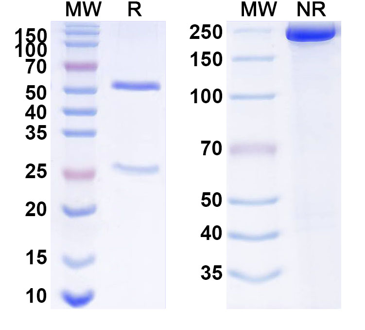 SDS-PAGE for Anti-Human SCN2B Antibody (ABS0496)