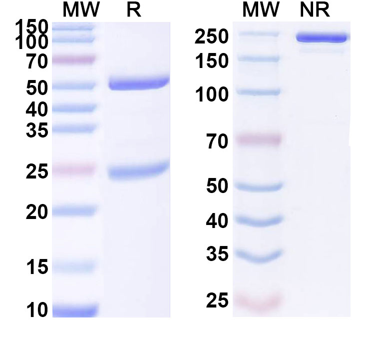 SDS-PAGE for Anti-Human SEMA4A Antibody (ABS1695)