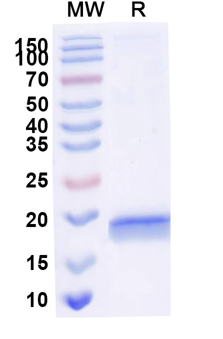 SDS-PAGE for Anti-Human SERPINE1/PAI-1 VHH (SAA1078)