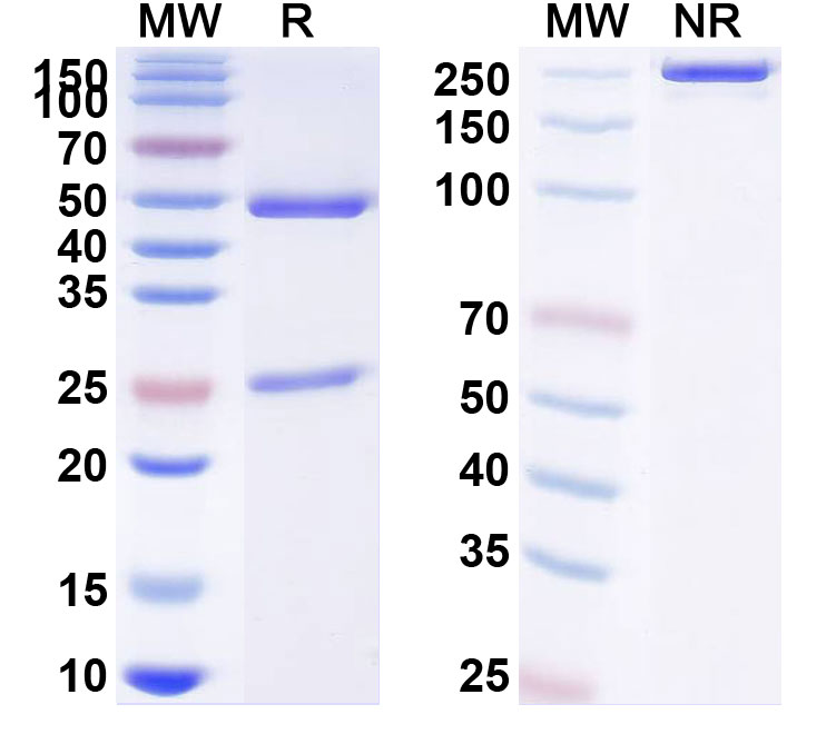 SDS-PAGE for Anti-Human SETMAR IP Antibody (SAA0224)