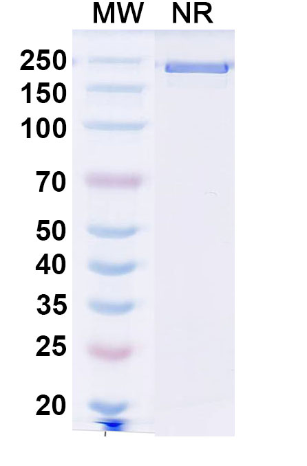 SDS-PAGE for Anti-Human SEZ6 Antibody (ABS1089)