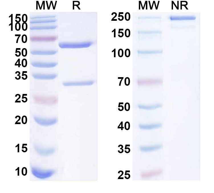 SDS-PAGE for Anti-Human SEZ6L2 Antibody (ABS0279)