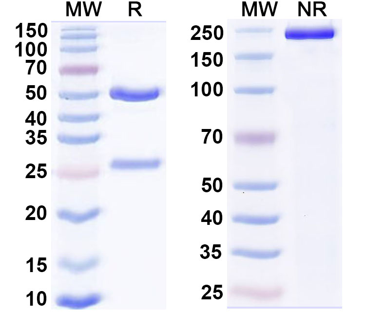 SDS-PAGE for Anti-Human SH2D1A Monoclonal Antibody (1A650)