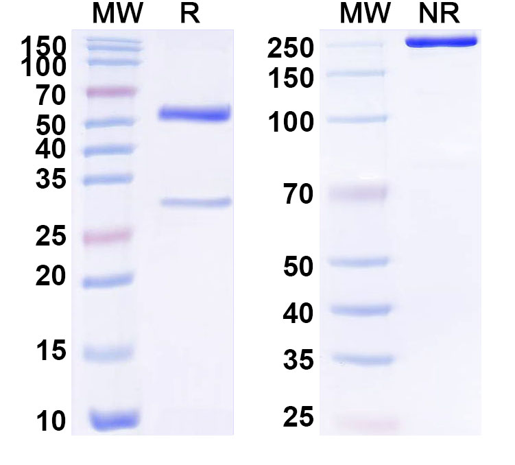SDS-PAGE for Anti-Human SLC39A12 Monoclonal Antibody (ABS1411)