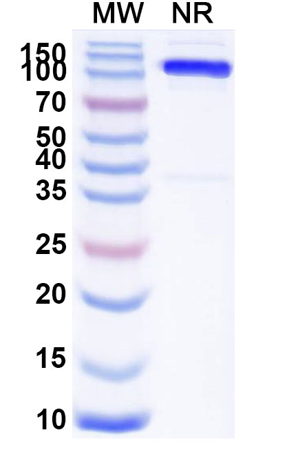 SDS-PAGE for Anti-Human SLC4A7 Monoclonal Antibody (ABS1523)