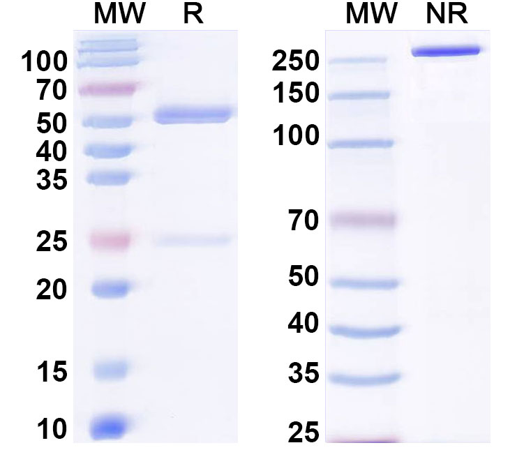 SDS-PAGE for Anti-Human SLC6A4/SERT Antibody (15B8)