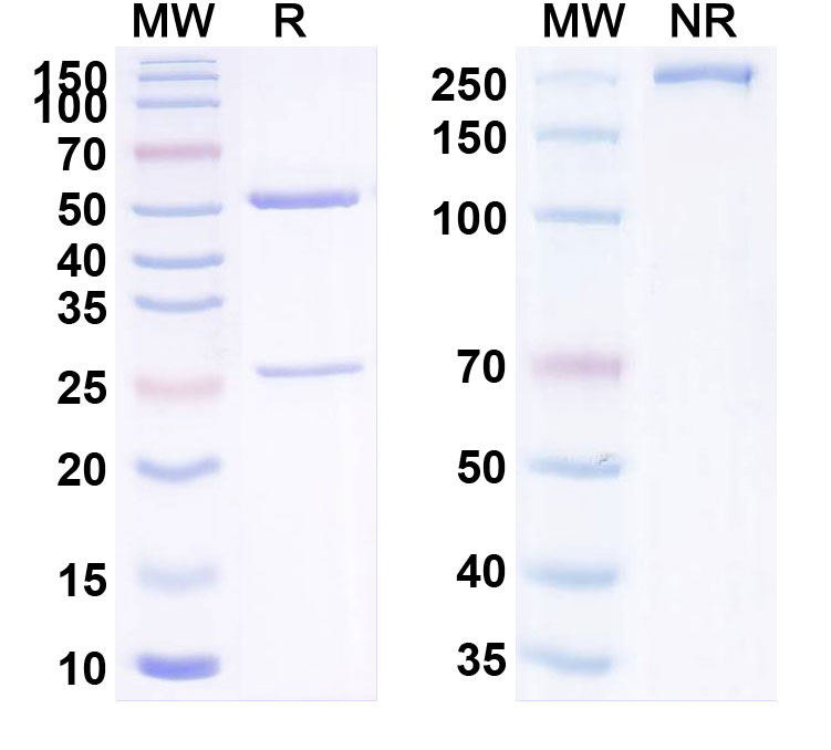 SDS-PAGE for Anti-Human SLC9B2 Antibody (SAA2256)