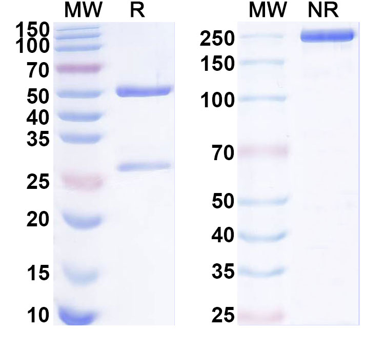 SDS-PAGE for Anti-Human SLPI Antibody (ABS0641)