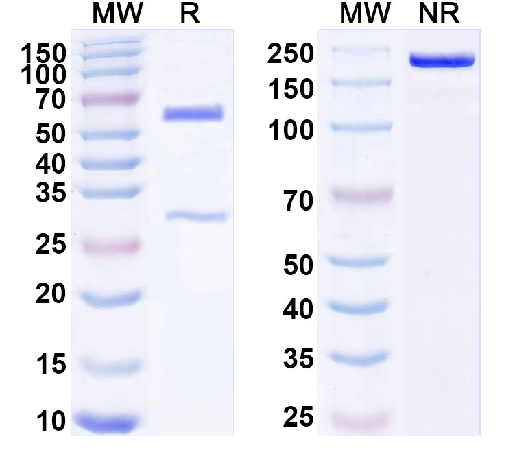SDS-PAGE for Anti-Human SMYD3 IP Antibody (SAA0230)