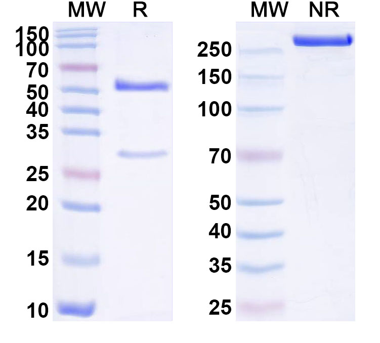 SDS-PAGE for Anti-Human SPINK1 Antibody (ABS0647)