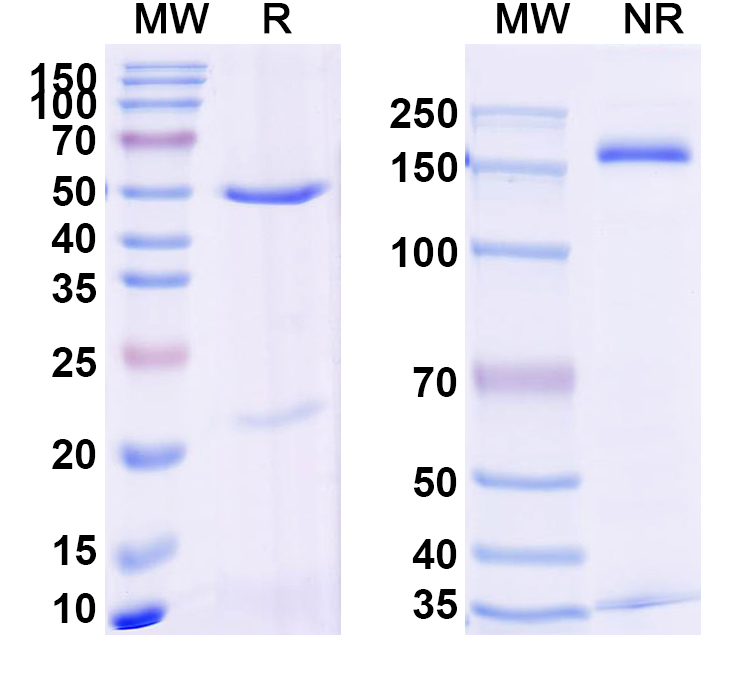 SDS-PAGE for Anti-Human STEAP4 Antibody (SAA2400)