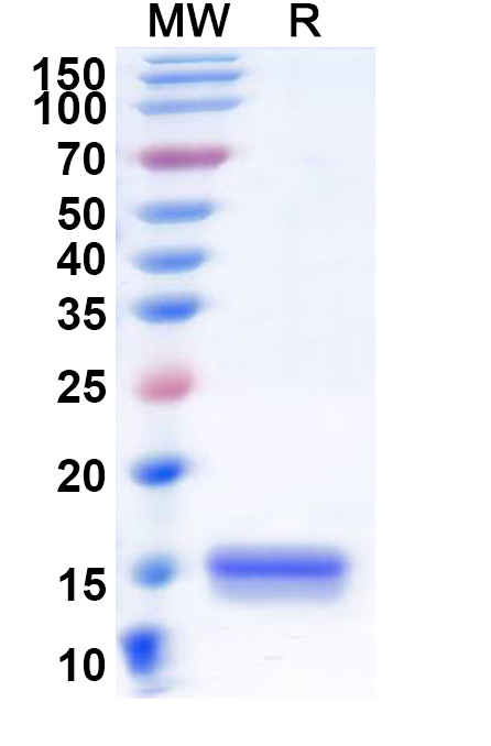 SDS-PAGE for Anti-Human SYNJ1 VHH (SAA1056)