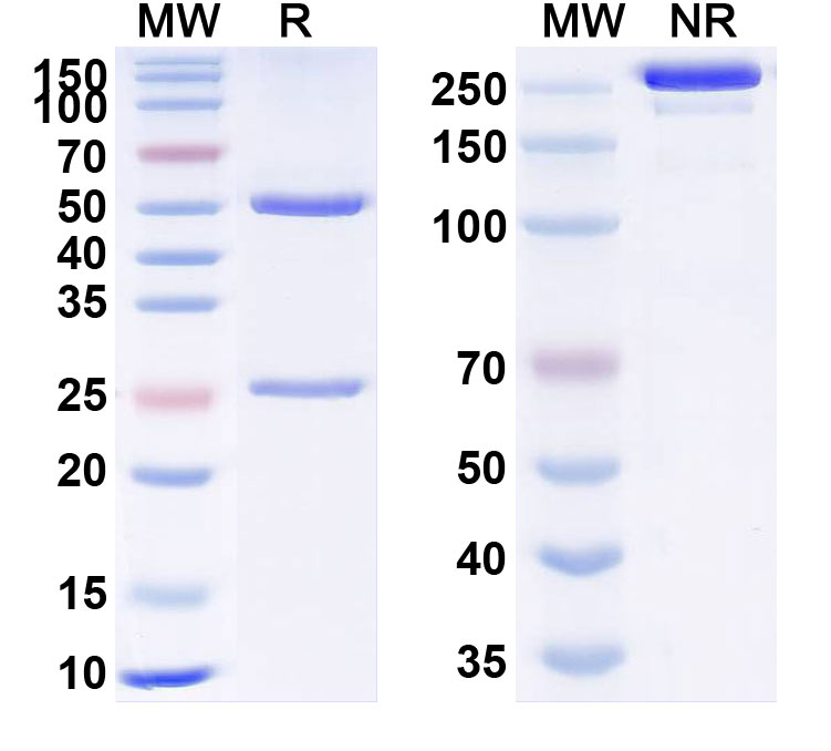 SDS-PAGE for Anti-Human TBL1X IP Antibody (SAA0233)