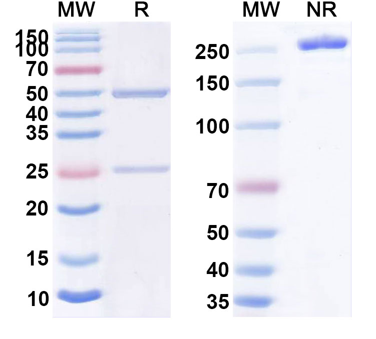 SDS-PAGE for Anti-Human TDRD3 IP Antibody (SAA0234)