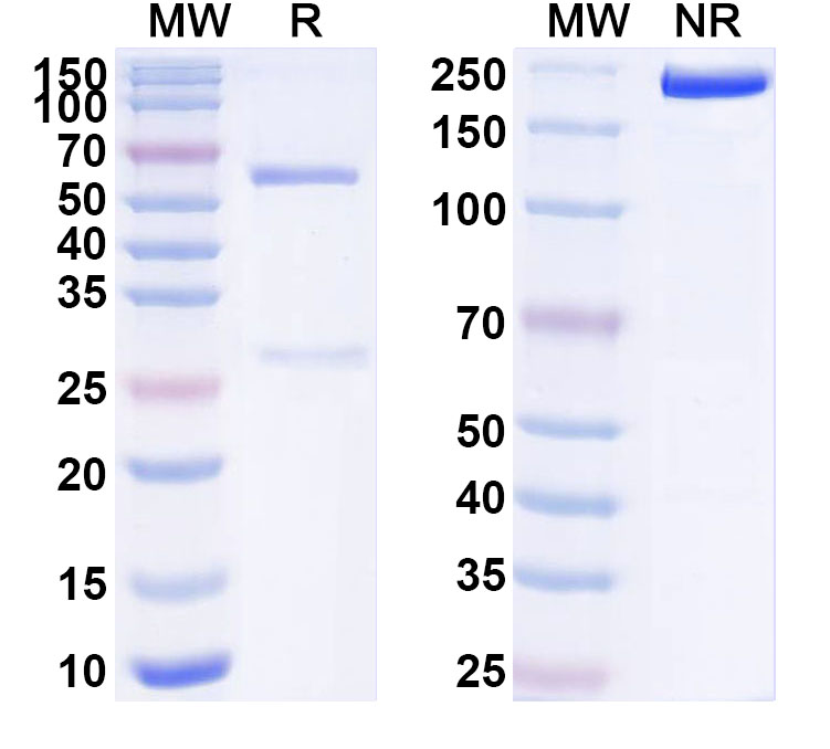 SDS-PAGE for Anti-Human TFF1 Antibody (ABS1583)