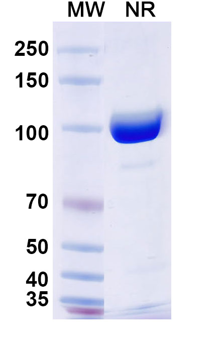 SDS-PAGE for Anti-Human TG/Thyroglobulin Antibody (SAA0534)
