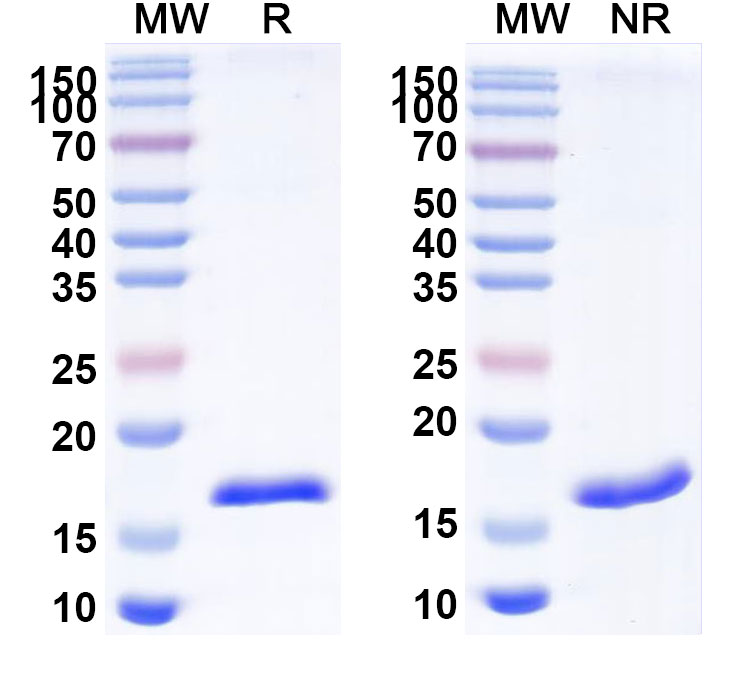 SDS-PAGE for Anti-Human TG/Thyroglobulin VHH (SAA1339)
