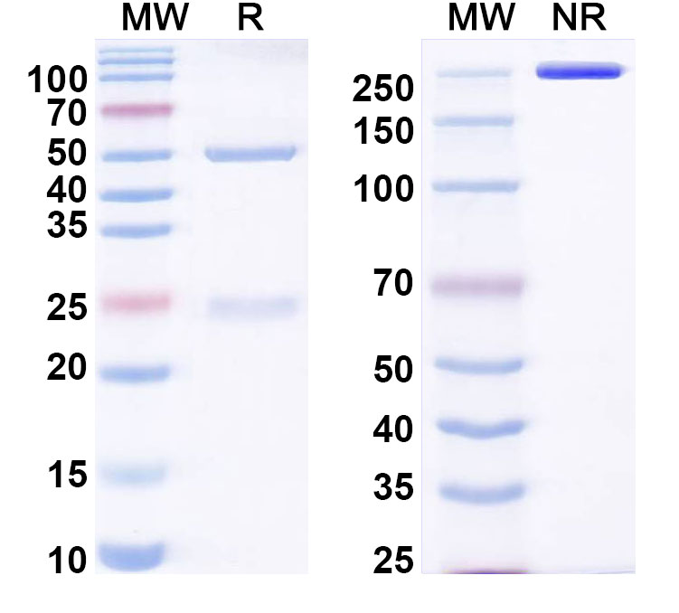 SDS-PAGE for Anti-Human TIMP2 Monoclonal Antibody, SAA0317