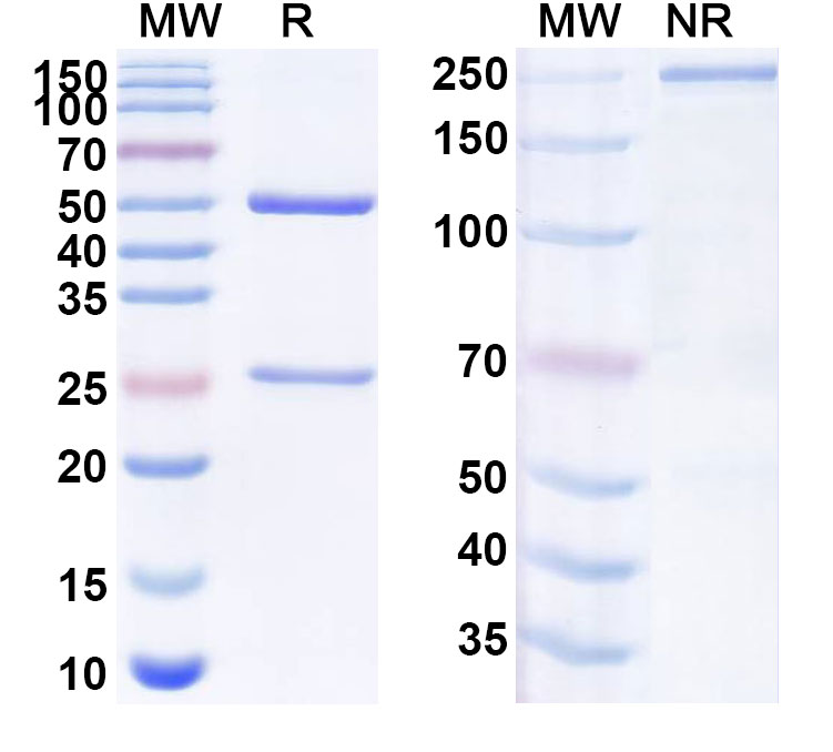 SDS-PAGE for Anti-Human TNFAIP6/TSG-6 Antibody (ABS1983)