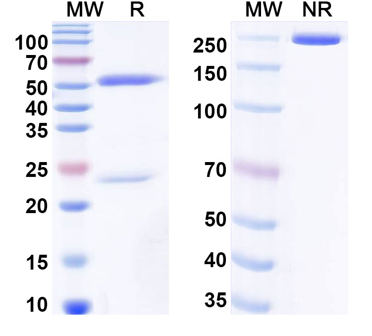 SDS-PAGE for Anti-Human TNN/Tenascin-N Antibody (SAA0517)