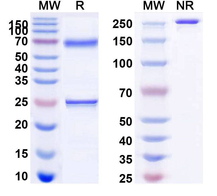 SDS-PAGE for Anti-Human TNNI3/cTNI Monoclonal Antibody (1A348)
