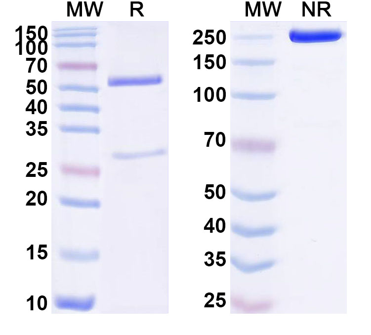 SDS-PAGE for Anti-Human TRBV9 Antibody (ABS1742)