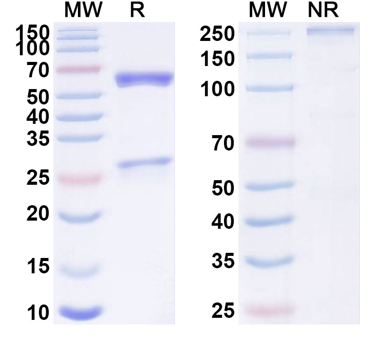 SDS-PAGE for Anti-Human TRIM28 IP Monoclonal Antibody, SAA0249