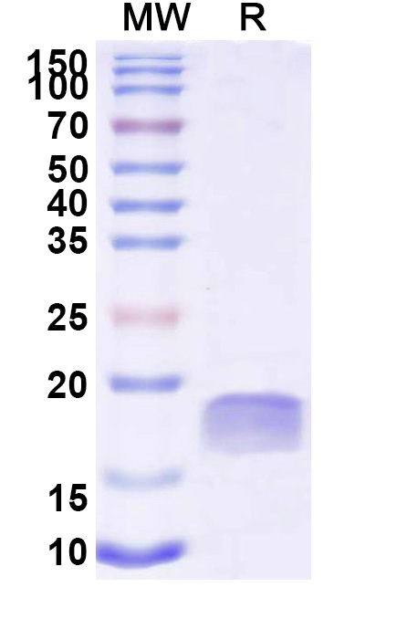 SDS-PAGE for Anti-Human TTYH2 VHH&reg; (SAA2300)