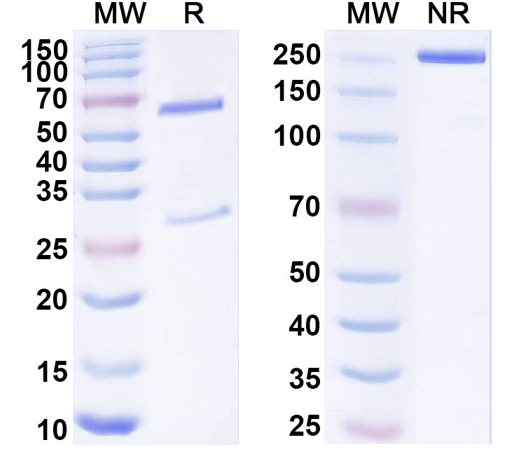 SDS-PAGE for Anti-Human TYRO3/DTK/SYK Monoclonal Antibody (ABS1258)