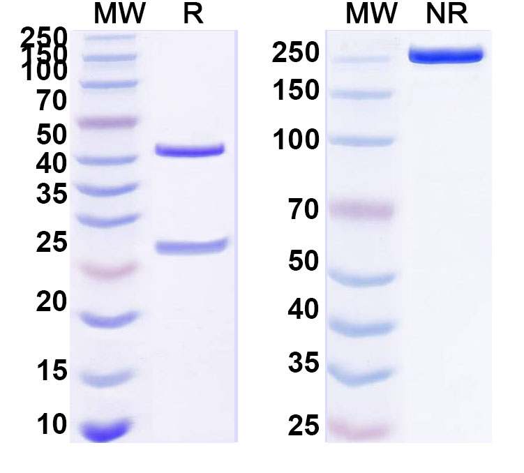 SDS-PAGE for Anti-Human UPK1B Antibody (ABS1864)