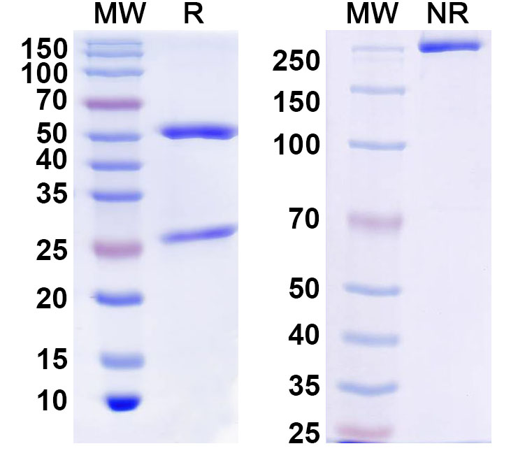SDS-PAGE for Anti-Human ZBTB39 Antibody (C88)