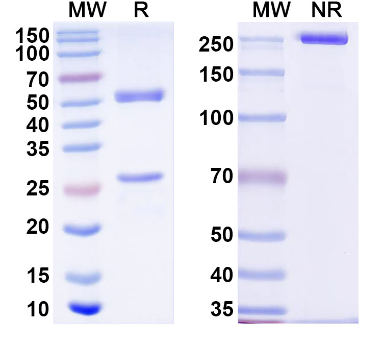 SDS-PAGE for Anti-Human ZBTB7B Antibody (C206)