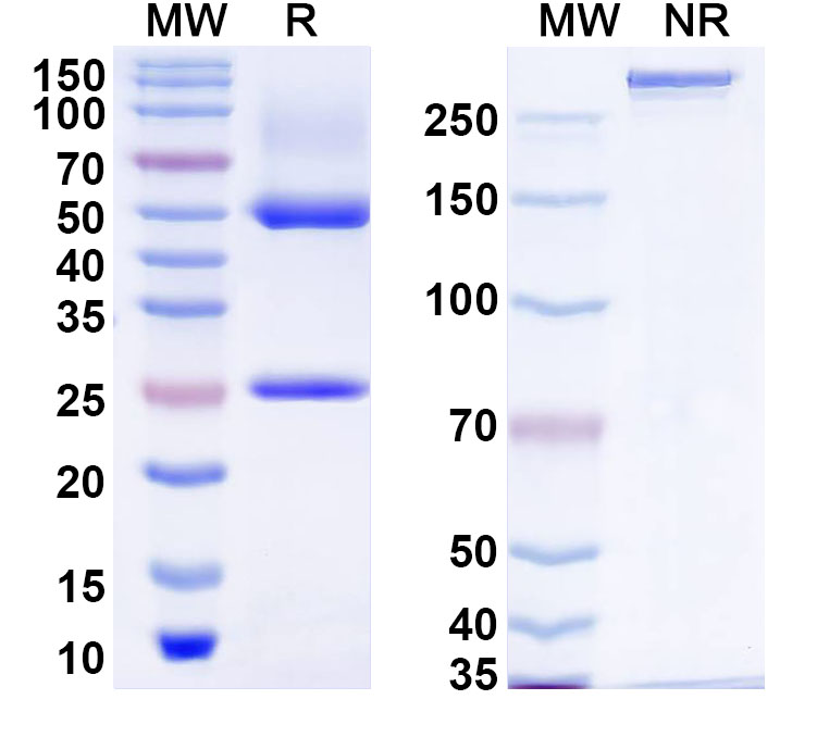 SDS-PAGE for Anti-Human ZFYVE20 Antibody (C18)