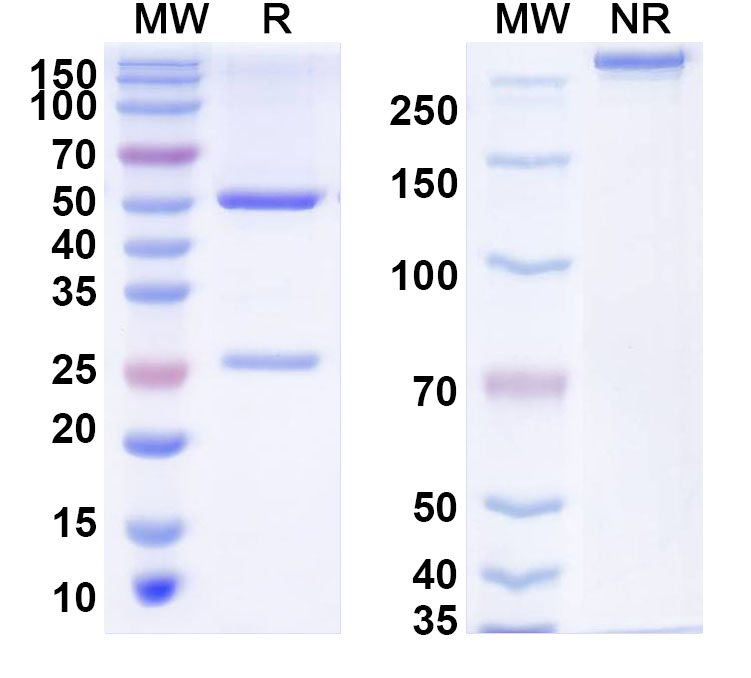 SDS-PAGE for Anti-Human ZKSCAN2 Antibody (C203)