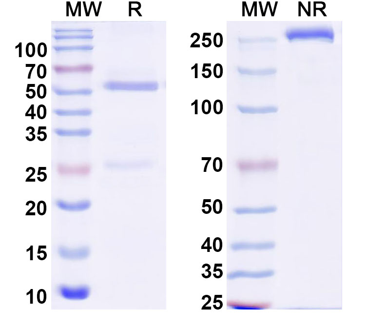 SDS-PAGE for Anti-Human ZKSCAN5 Antibody (S75)