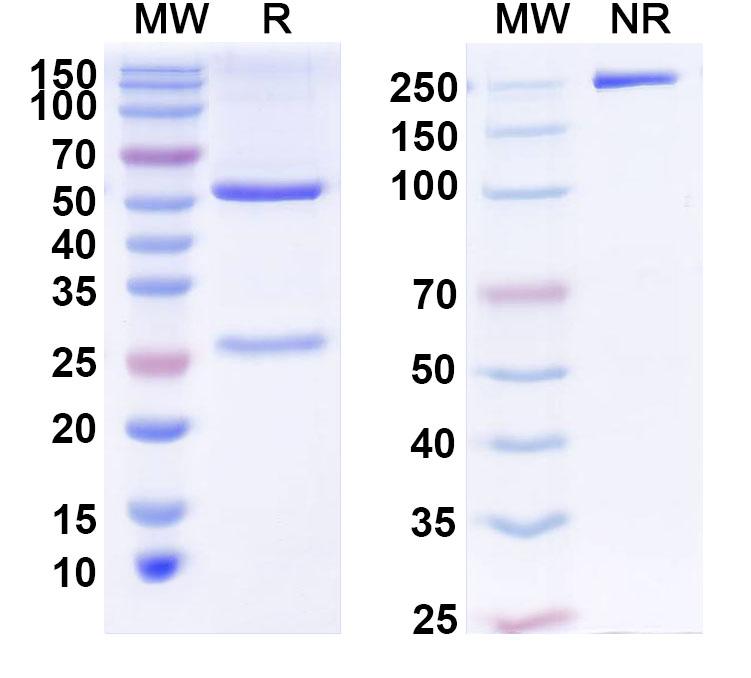 SDS-PAGE for Anti-Human ZKSCAN8 Antibody (C49)