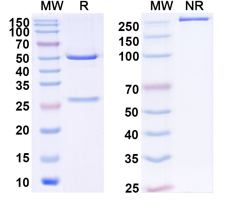 SDS-PAGE for Anti-Human ZNF18 Antibody (S12)