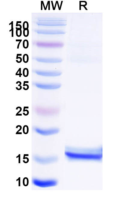 SDS-PAGE for Anti-Influenza A virus/H1N1 NP/Nucleoprotein VHH (SAA1023)