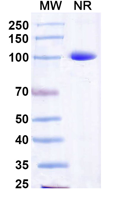 SDS-PAGE for Anti-Influenza B virus Neuraminidase/NA VHH (SAA2308)