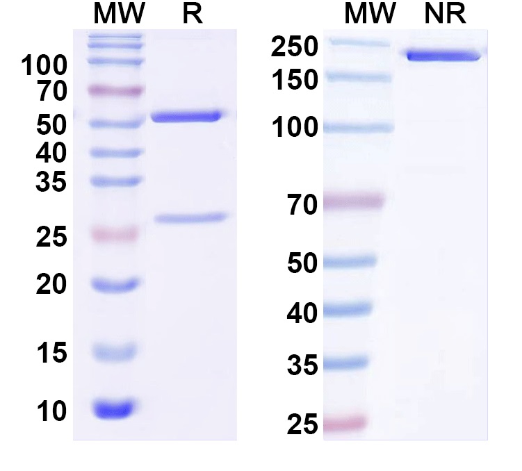 SDS-PAGE for Anti-ITPR Antibody (N350/38)