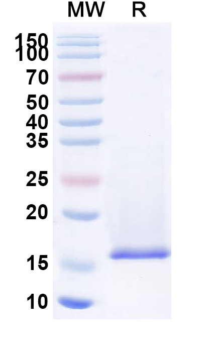 SDS-PAGE for Anti-JUNV Nucleoprotein VHH (SAA2268)