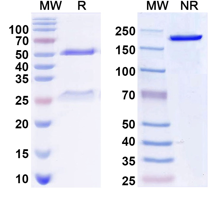 SDS-PAGE for Anti-KCC2 Antibody (N1/12)