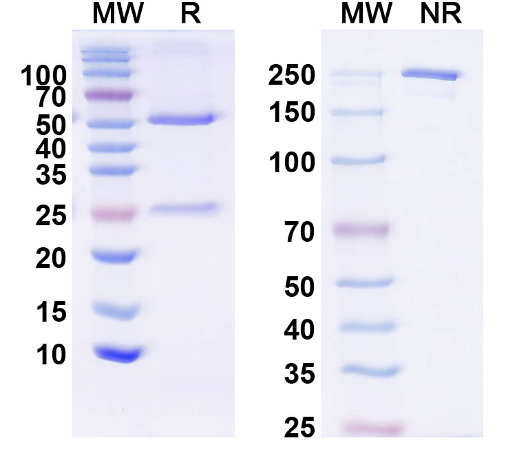 SDS-PAGE for Anti-KChIP1 K+ channel Antibody (K59/11)