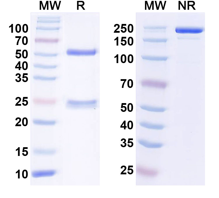 SDS-PAGE for Anti-Kv6.1 K+ channel Antibody (N474/2)