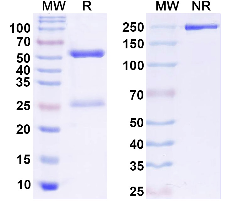 SDS-PAGE for Anti-Kv8.2 K+ channel Antibody (N448/40)