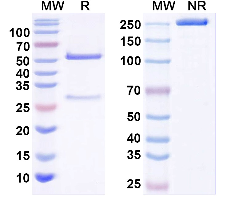 SDS-PAGE for Anti-Kvbeta1.1 K+ channel Antibody (K40/17)