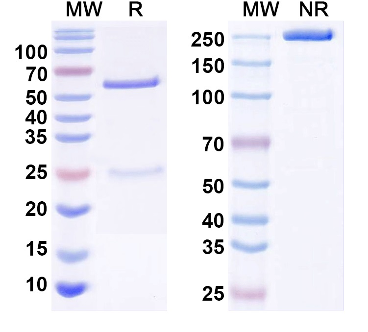 SDS-PAGE for Anti-Kvbeta1.2 K+ channel Antibody (K47/34)