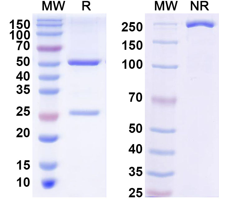 SDS-PAGE for Anti-Langya virus/LayV G/Glycoprotein Antibody (SAA2451)