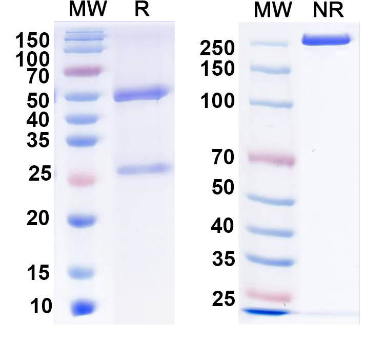 SDS-PAGE for Anti-Lgi1 Antibody (N283/26)