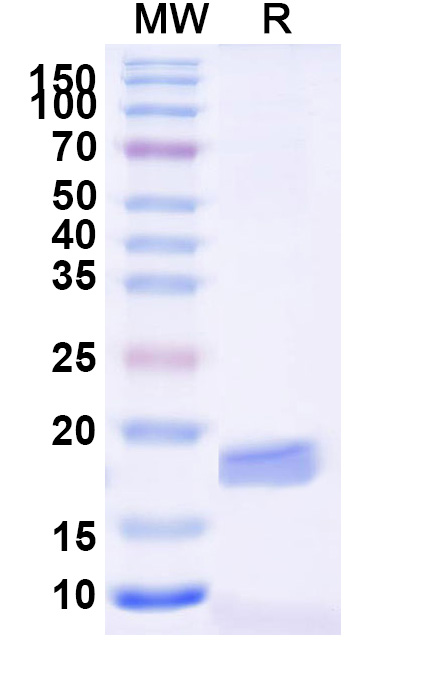 SDS-PAGE for Anti-Listeria monocytogenes serotype 1/2a InlB/Internalin B VHH (SAA0997)